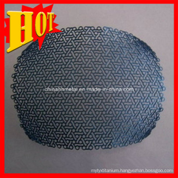 Maxillofacial Metallic Implant Titanium Mesh Titanium Surgical Mesh